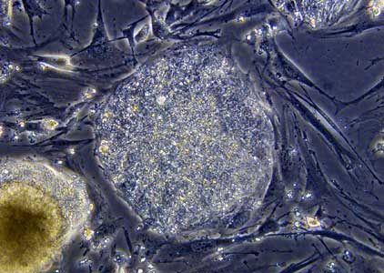 Adult stem cell