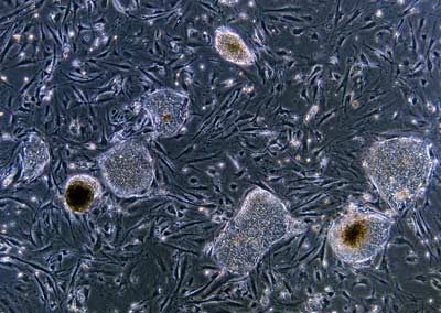 Stem cell