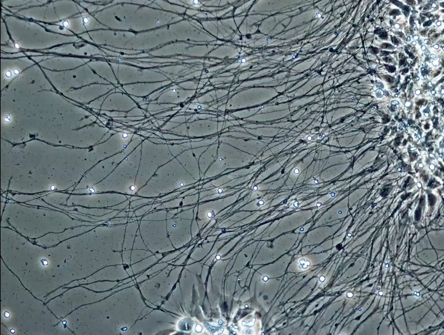 Neural network