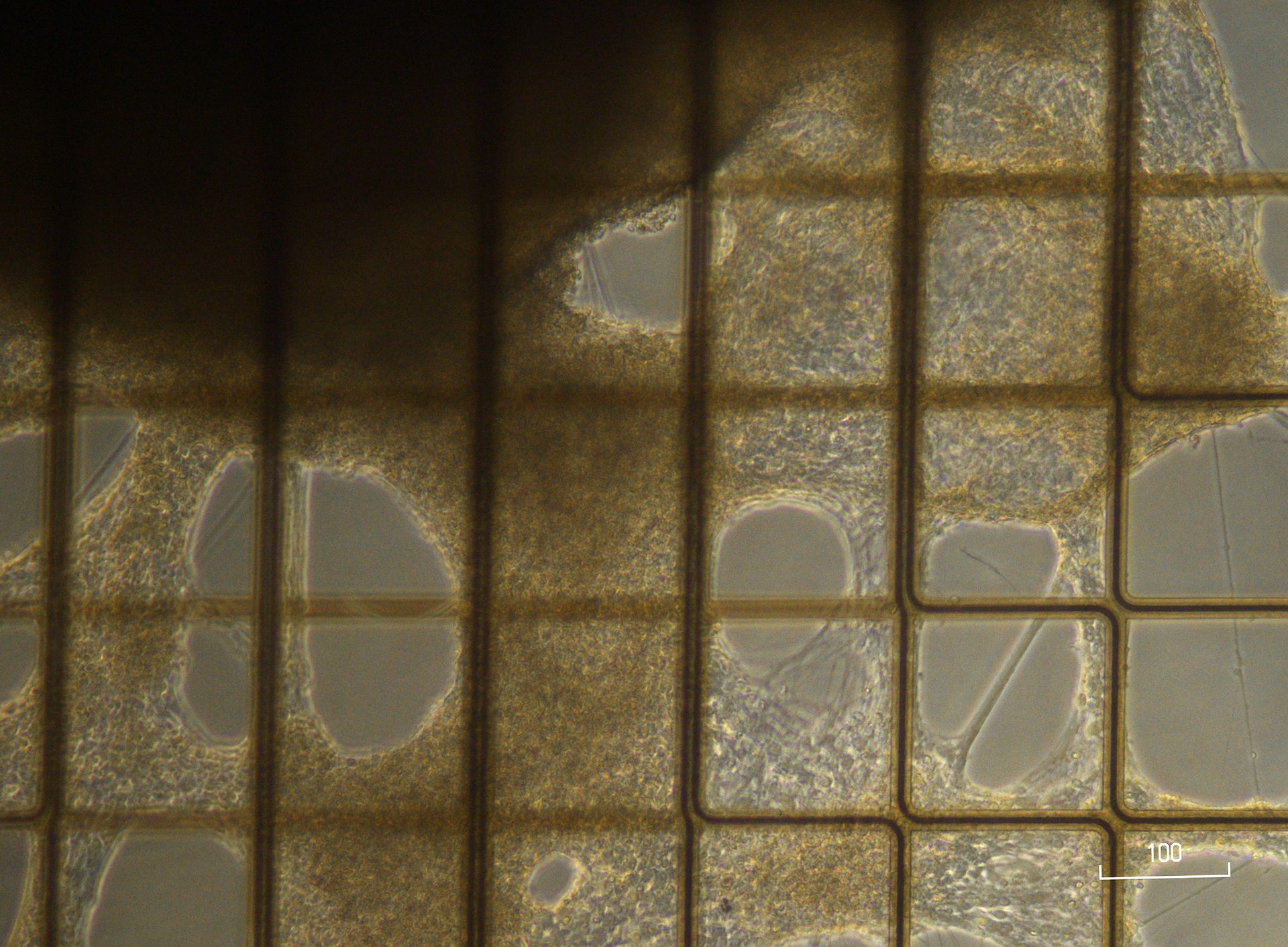 Organoid